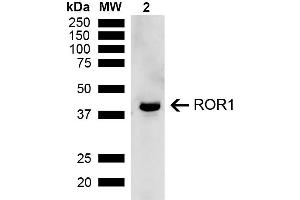 Western blot analysis of Rat Kidney showing detection of ~43 kDa ROR1 protein using Rabbit Anti-ROR1 Polyclonal Antibody (ABIN5667778).
