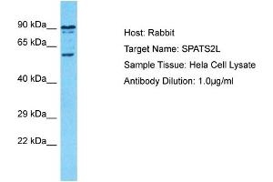 Host: Rabbit Target Name: SPATS2L Sample Type: Hela Whole Cell lysates Antibody Dilution: 1. (SPATS2L 抗体  (C-Term))