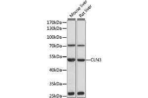 Western blot analysis of extracts of various cell lines, using CLN3 antibody (ABIN3015724, ABIN3015725, ABIN1679284 and ABIN6219075) at 1:1000 dilution. (CLN3 抗体  (AA 1-280))