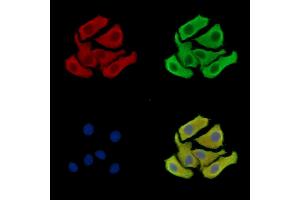 anti-Attractin-Like 1 (ATRNL1) antibody