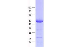 Western Blotting (WB) image for Nicotinate phosphoribosyltransferase (NAPRT) protein (His tag) (ABIN2726822)