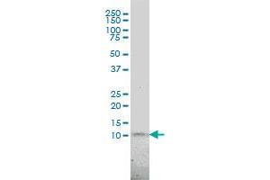 Western Blotting (WB) image for anti-PCNA Clamp Associated Factor (PAF) (AA 1-111) antibody (ABIN564218)