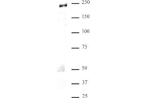 MED1 antibody (pAb) tested by Western blot. (MED1 抗体  (C-Term))