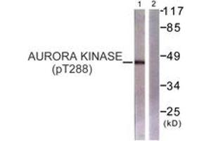 anti-Aurora Kinase (AA 256-305), (pThr288) antibody