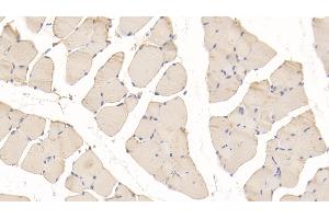 Detection of PYGM in Mouse Skeletal muscle Tissue using Polyclonal Antibody to Glycogen Phosphorylase, Muscle (PYGM)