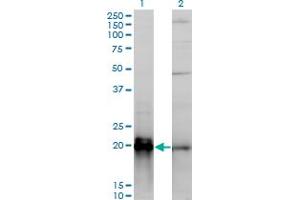 Western Blot analysis of KRAS expression in transfected 293T cell line by KRAS monoclonal antibody (M01), clone 3B10-2F2. (K-RAS 抗体  (AA 1-188))