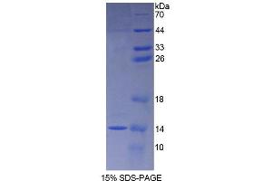 SDS-PAGE (SDS) image for S100 Calcium Binding Protein A8 (S100A8) (AA 1-89) protein (His tag) (ABIN1080749) (S100A8 Protein (AA 1-89) (His tag))