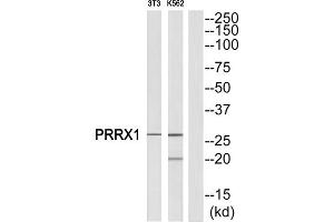 Western Blotting (WB) image for anti-Paired Related Homeobox 1 (PRRX1) (Internal Region) antibody (ABIN1851770) (PRRX1 抗体  (Internal Region))