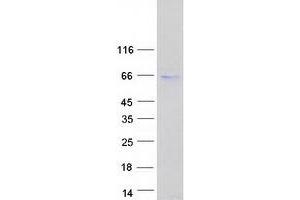 Western Blotting (WB) image for Patatin-Like phospholipase Domain Containing 2 (PNPLA2) protein (Myc-DYKDDDDK Tag) (ABIN2729262)