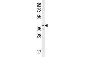 Caspase-12 antibody western blot analysis in HL-60 lysate