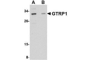 Western blot analysis of GRTP1 in SK-N-SH cell lysate with AP30388PU-N GRTP1 antibody at 1 μg/ml in the (A) absence and (B) presence of blocking peptide. (GRTP1 抗体  (Center))
