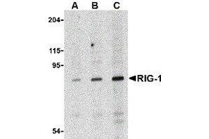 Western Blotting (WB) image for anti-DEAD (Asp-Glu-Ala-Asp) Box Polypeptide 58 (DDX58) antibody (ABIN2476364)