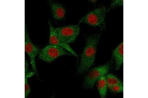Immunofluorescence (IF) image for anti-5'-Nucleotidase, Ecto (CD73) (NT5E) antibody (ABIN6940229)