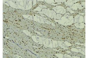 ABIN6277442 at 1/100 staining Mouse muscle tissue by IHC-P. (TRIM63 抗体  (N-Term))