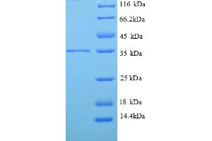 SDS-PAGE (SDS) image for Tropomyosin-2 (TPM2) (AA 14-284), (partial) protein (His tag) (ABIN5712854) (TPM2 Protein (AA 14-284, partial) (His tag))