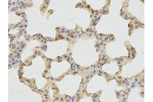 Immunohistochemistry (IHC) image for anti-Cathepsin D (CTSD) antibody (ABIN1872099) (Cathepsin D 抗体)
