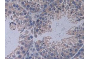 Immunohistochemistry (IHC) image for anti-Interleukin 12 alpha (IL12A) (AA 23-215) antibody (ABIN7430654)