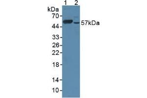 Figure. (CYP17A1 抗体  (AA 201-507))