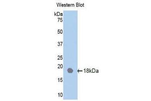 Western Blotting (WB) image for anti-Interleukin 18 Receptor Accessory Protein (IL18RAP) (AA 117-240) antibody (ABIN1859375) (IL18RAP 抗体  (AA 117-240))