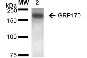 Western Blot analysis of Rat Liver showing detection of ~170 kDa GRP170 protein using Mouse Anti-GRP170 Monoclonal Antibody, Clone 6E3-2C3 (ABIN2868628). (HYOU1 抗体)