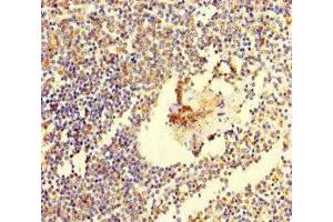 Immunohistochemistry of paraffin-embedded human spleen tissue using ABIN7171802 at dilution of 1:100 (TSBP1 (AA 239-476) 抗体)