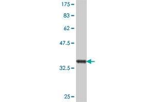 Western Blot detection against Immunogen (37 KDa) . (PTGR1 抗体  (AA 230-328))