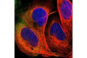 Immunofluorescent staining of human cell line U-2 OS shows localization to cytosol. (PDE5A 抗体  (AA 303-442))