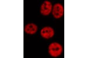 ABIN6267012 staining Hela by IF/ICC. (CTBP1 抗体  (Internal Region))