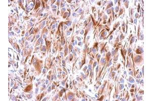 IHC-P Image Immunohistochemical analysis of paraffin-embedded U374 xenograft, using Frizzled 9, antibody at 1:500 dilution. (FZD9 抗体  (N-Term))