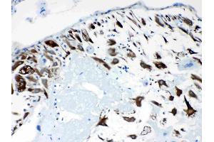 Immunohistochemistry (IHC) image for anti-Protein Phosphatase 1, Regulatory (Inhibitor) Subunit 14A (PPP1R14A) (AA 30-126) antibody (ABIN5518865)