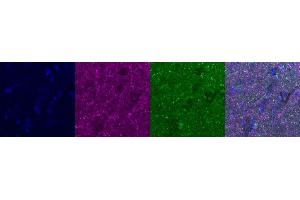Immunohistochemistry (IHC) image for anti-Cannabinoid Receptor 1 (CNR1) antibody (ABIN7456057) (CNR1 抗体)