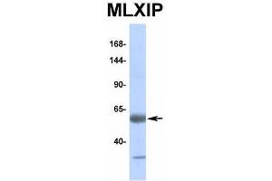 Host:  Rabbit  Target Name:  MLXIP  Sample Type:  Human Fetal Lung  Antibody Dilution:  1.