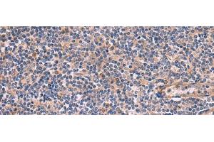 Immunohistochemistry of paraffin-embedded Human tonsil tissue using ARIH2 Polyclonal Antibody at dilution of 1:80(x200) (ARIH2 抗体)