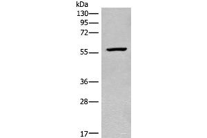 Western blot analysis of Mouse heart tissue lysate using CDADC1 Polyclonal Antibody at dilution of 1:450 (CDADC1 抗体)