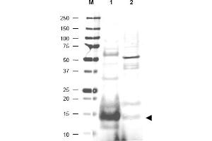 Image no. 1 for anti-Ubiquitin-Conjugating Enzyme E2N (UBE2N) (AA 40-51) antibody (ABIN401175) (UBE2N 抗体  (AA 40-51))