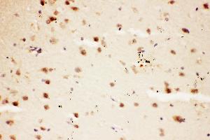 Anti-NMDAR2A antibody,  IHC(P) IHC(P): Rat Brain Tissue