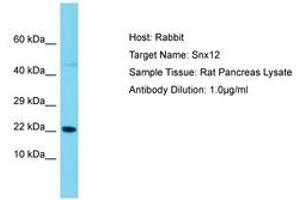 Image no. 1 for anti-Sorting Nexin 12 (SNX12) (AA 86-135) antibody (ABIN6750493) (SNX12 抗体  (AA 86-135))