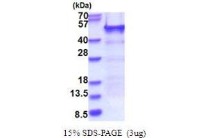 SDS-PAGE (SDS) image for RD RNA Binding Protein (RDBP) (AA 1-380) protein (His tag) (ABIN6387428)