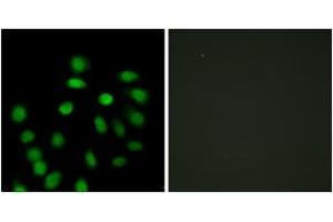 Immunofluorescence analysis of HepG2 cells, using SCAND1 Antibody. (SCAND1 抗体  (AA 61-110))
