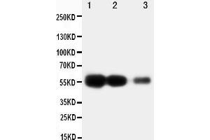 Anti-RAGE antibody, Western blotting Lane 1: Recombinant Human RAGE Protein 10ng Lane 2: Recombinant Human RAGE Protein 5ng Lane 3: Recombinant Human RAGE Protein 2. (RAGE 抗体  (Middle Region))