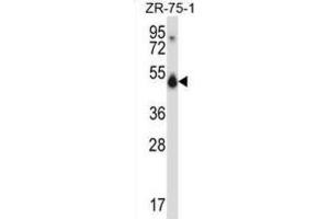 Western Blotting (WB) image for anti-CUGBP, Elav-Like Family Member 1 (CELF1) antibody (ABIN2997688) (CELF1 抗体)