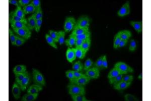 Immunofluorescence staining of HepG2 cells with ABIN7159352 at 1:133, counter-stained with DAPI. (MAGI1 抗体  (AA 1234-1367))