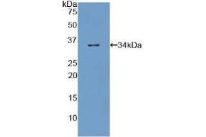 Detection of Recombinant COL7, Human using Polyclonal Antibody to Collagen Type VII (COL7)