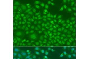 Immunofluorescence analysis of U2OS cells using NIN Polyclonal Antibody at dilution of 1:100. (Ninein 抗体)