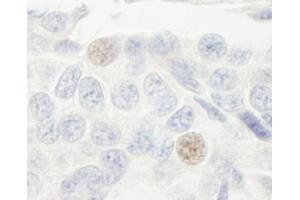 Immunohistochemistry (IHC) image for anti-General Transcription Factor IIIC, Polypeptide 2, beta 110kDa (GTF3C2) (AA 75-125) antibody (ABIN7454394)