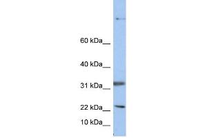 WB Suggested Anti-SEAntibody Titration:  0. (Sep 15 抗体  (Middle Region))