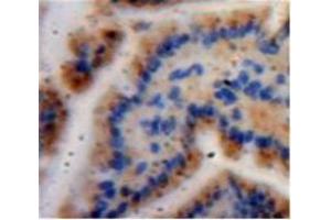 Used in DAB staining on fromalin fixed paraffin-embedded Bowels tissue (Caspase 6 抗体  (AA 194-293))