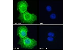 ABIN184586 Immunofluorescence analysis of paraformaldehyde fixed A431 cells, permeabilized with 0. (MAX 抗体  (C-Term))