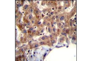 MBNL2 Antibody (C-term) (ABIN656947 and ABIN2846136) immunohistochemistry analysis in formalin fixed and paraffin embedded human liver tissue followed by peroxidase conjugation of the secondary antibody and DAB staining. (MBNL2 抗体  (C-Term))