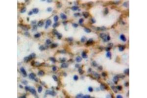 Used in DAB staining on fromalin fixed paraffin-embedded Spleen tissue (CD160 抗体  (AA 37-154))